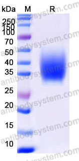 Recombinant Human CD371/CLEC12A Protein, N-His (Active)