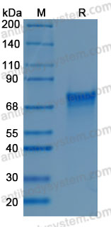 Recombinant Human CNDP1 Protein, C-10*His (Active)