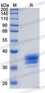 Recombinant Human CLMP/ASAM Protein, C-His (Active)