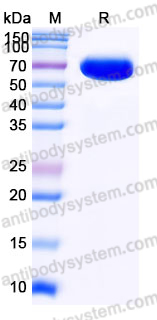 Recombinant Human SIGLEC15/CD33L3 Protein, C-Fc (Active)