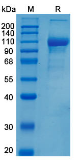 Recombinant Human SEMA4C Protein, C-hFc (Active)