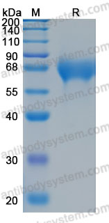 Recombinant Human TIMD4/TIM-4 Protein, C-His (Active)