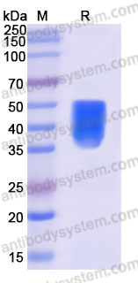 Recombinant Human TSLPR/CRLF2 Protein, C-His (Active)