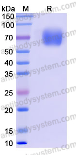 Recombinant Human TSLPR/CRLF2 Protein, C-Fc (Active)