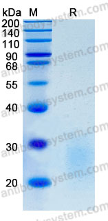 Recombinant Human TMIGD2/CD28H/IGPR1 Protein, C-His (Active)