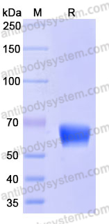 Recombinant Human HHLA2/B7-H7 Protein, C-His (Active)