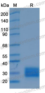 Recombinant Human ULBP1 Protein, C-His (Active)
