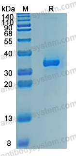 Recombinant Human SFRP2 Protein, C-His (Active)