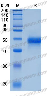 Recombinant Human NTNG1/Netrin-G1 Protein, C-His (Active)
