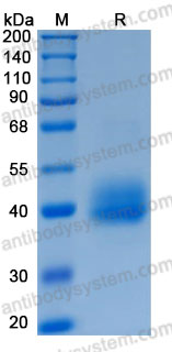Recombinant Human ANTXR1/TEM8 Protein, C-His (Active)