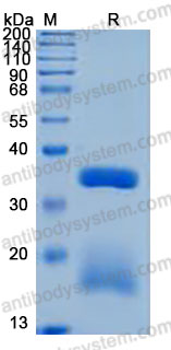 Recombinant Human RGMB Protein, C-His (Active)