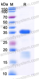 Recombinant Human RGMB Protein, C-His (Active)