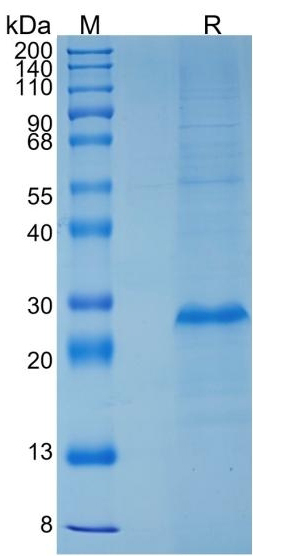 SDS-PAGE for Recombinant Human RSPO2 Protein, C-His (Active) ?>
