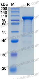 Recombinant Human NLGN3 Protein, C-His (Active)