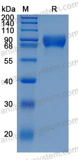 Recombinant Human FLRT3 Protein, C-His (Active)
