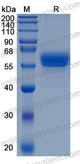 Recombinant Human Osteomodulin/OMD Protein, C-His (Active)