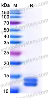 Recombinant Human ITPRIPL1 Protein, C-His (Active)