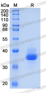 Recombinant Human CTRC Protein, C-His (Active)