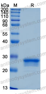 Recombinant Human ULBP3 Protein, C-His (Active)