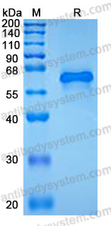 Recombinant Human SMOC1 Protein, C-His (Active)