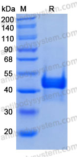 Recombinant Human CA14 Protein, C-10*His (Active)