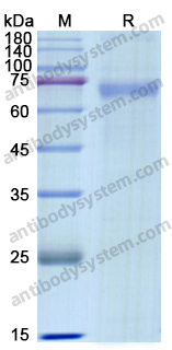 Recombinant Human DSG1 Protein