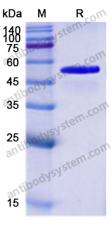 Recombinant Human TRIM21/RO52 Protein
