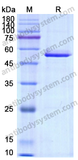Recombinant Human Calreticulin/CALR Protein