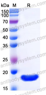 Recombinant Mouse TNFSF15/TL1A Protein, Tag free (Active)