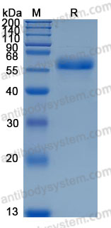 Recombinant Mouse CCN4/WISP-1 Protein, C-10*His (Active)