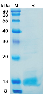 SDS-PAGE for Recombinant Mouse C3/Complement C3 Protein, C-His (Active) ?>