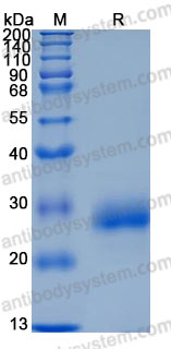 Recombinant Mouse TIMP1 Protein, C-His (Active)