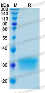 Recombinant Mouse IFNB1/IFN-beta Protein, C-His (Active)