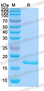 Recombinant Mouse IL1B/IL1F2 Protein, C-His (Active)