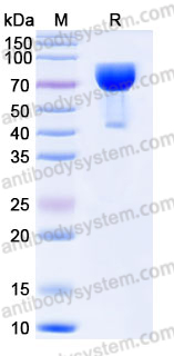 Recombinant Mouse CD25/IL2RA Protein, C-Fc (Active)
