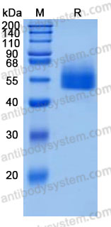 Recombinant Mouse CD4 Protein, C-His (Active)