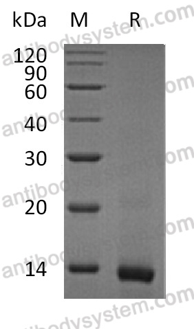 Recombinant Mouse IL4 Protein, Tag free (Active)
