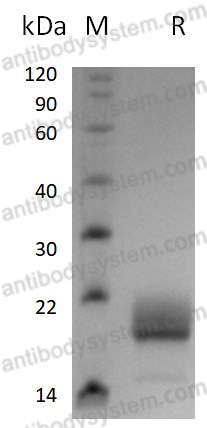 Recombinant Mouse IL4 Protein, C-His (Active)
