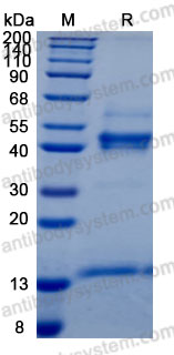 Recombinant Mouse IL6/Interleukin-6 Protein, C-His (Active)