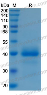Recombinant Mouse CTSB Protein, C-10*His (Active)
