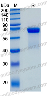 Recombinant Mouse OPN/Spp1 Protein, C-His (Active)