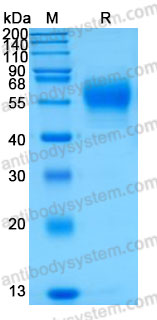Recombinant Mouse CD121a/IL1R1 Protein, C-His (Active)