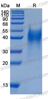 Recombinant Mouse LIF Protein, C-His (Active)