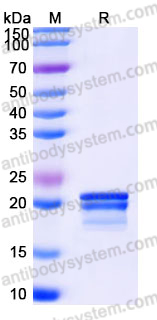 Recombinant Mouse VEGF164 Protein, Tag free (Active)