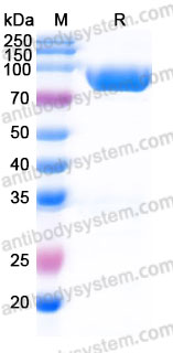 Biotinylated Mouse CD36 Protein, C-Avi-His