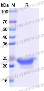Recombinant Mouse CD252/OX40L Protein, N-8*His (Active)