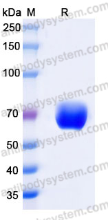 Recombinant Mouse CD124/IL4R/IL-4R&alpha; Protein, C-Fc (Active)