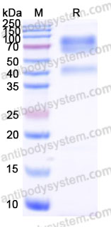 Recombinant Mouse CD215/IL15RA Protein, C-Fc (Active)