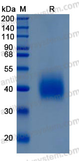 Recombinant Mouse CD150/SLAMF1 Protein, C-His (Active)