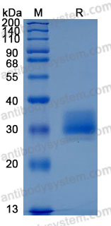 Recombinant Mouse IL20RB Protein, C-His (Active)